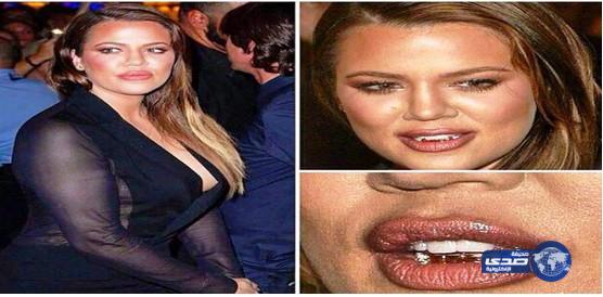 أحلام غاضبة من كاردشيان: أمي غلفت أسنانها بالذهب قبل 40 عاماً