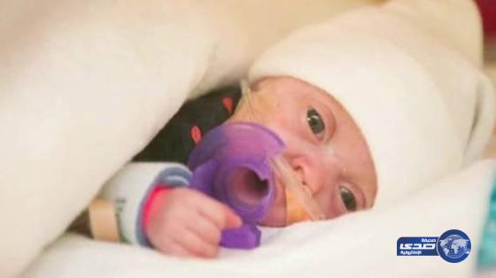 بالفيديو.. ولادة أصغر طفلة في العالم بحجم الآيفون