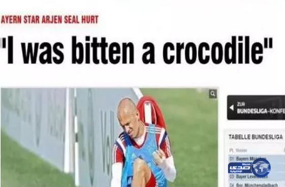 روبن : تعرضت لعضة تمساح في قطر