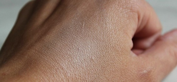 دراسة :جلد الإنسان يُرشده إلى كيفية كبح الشهية