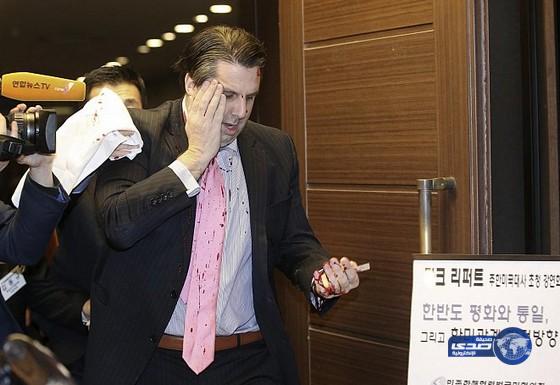 إصابة السفير الأمريكي في هجوم مسلح بالعاصمة الكورية