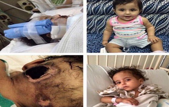 طفلة سعودية تعاني من مرض نادر و عائلتها تناشد الأسرة الكريمة لمعالجتها