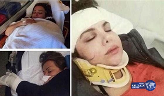 بالصور:اصابة منى شداد ومها محمد في حادث مروي