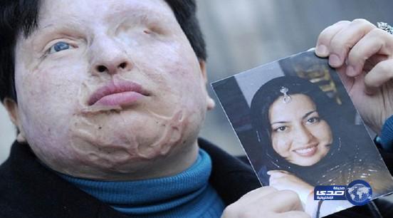 الحكم على إيراني باقتلاع عينيه وقطع أذنه