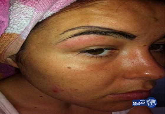 شابة بريطانية بأربعة حواجب