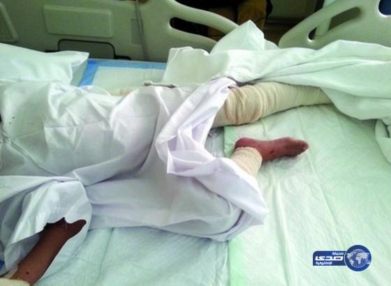 خادمة في الامارات تحرق طفلاً بمادة كاوية