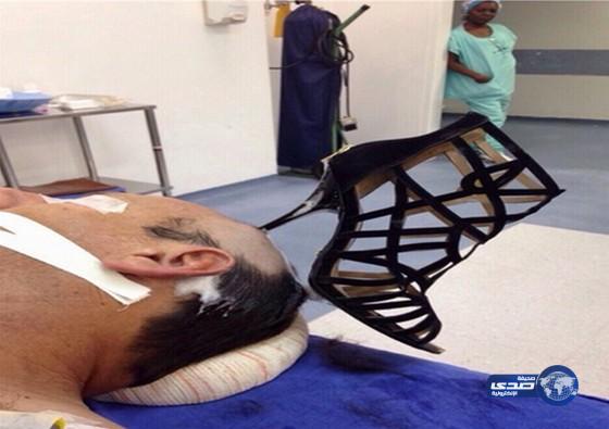 ممرضة تفتقد الرحمة تنظر ببرود لرجل مسجى والكعب مغروس في رأسة