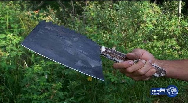 هندوراسي يقطع قدم زوجته بسبب الغيرة