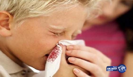 أسباب نزيف الأنف عند الأطفال وطرق علاجه