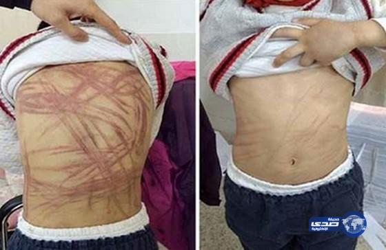 جلد طفل لأنه لا يعرف قصة “بينوكيو”