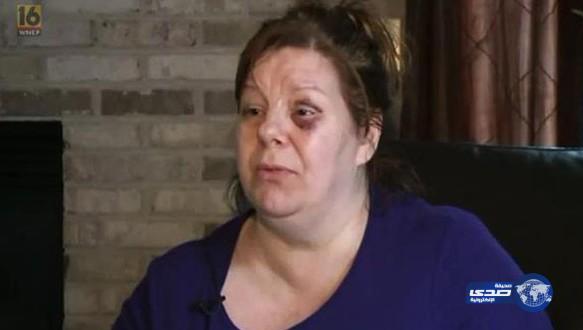 امرأة ذهبت لمشاهدة فيلم فيوريس 7 فعادت متورمة الوجه