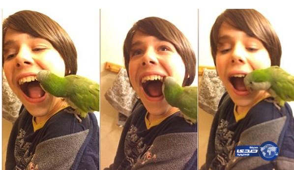 بالفيديو: طفل يقتلع ضرسه بواسطة ببغاء في ثوان معدودة