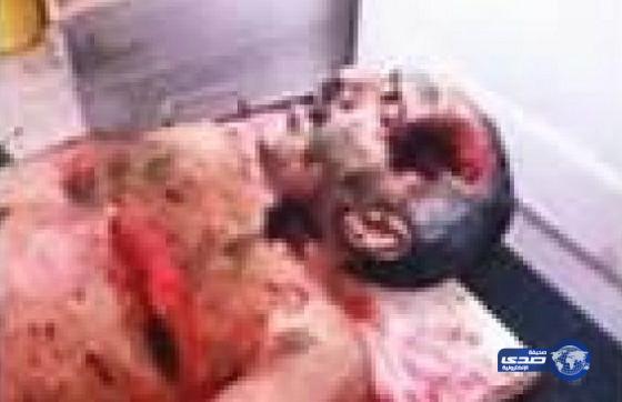 صورة ترجح مقتل الرئيس اليمني المخلوع علي عبدالله صالح