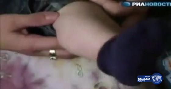 بالفيديو.. طفل روسي معجزة تظهر على جسمه آيات قرآنية.. كل جمعة‎