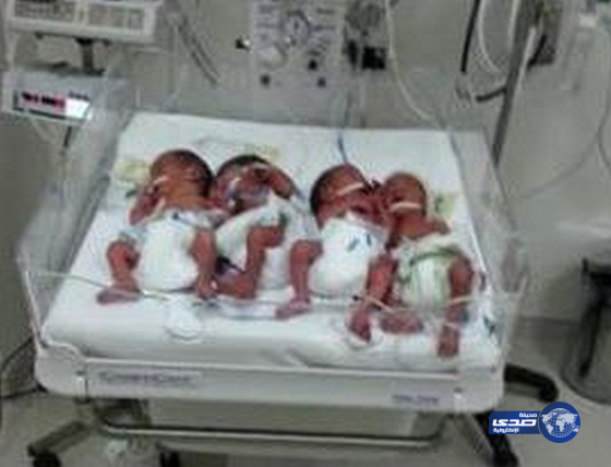 مواطنة عشرينية تُرزق بـ 4 توائم في الجوف (صورة)