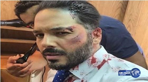 رامى عياش يتعرض لضرب مبرح يسيل الدماء من وجهه بسبب فتاة في الشارع