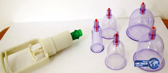 تدريب أكثر من 100 ممارس صحي على الحجامة