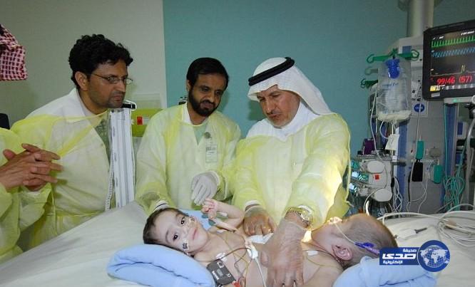 فصل التوأم السيامي اليمني عبدالعزيز وعبدالله في الرياض.. الجمعة