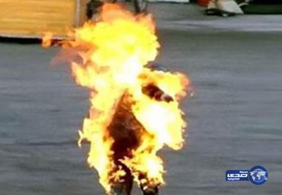 رجل يشعل النيران بجسد زوجته لخروجها دون علمه