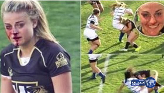 بالفيديو.. لاعبة رجبي تضحي بجمالها وتواصل اللعب بأنف مكسور