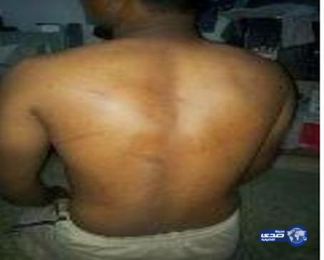 كفيل يعتدي بالضرب على سائقه الهندي بآلة حادة