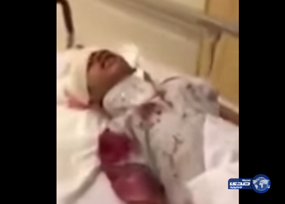 رفع نتائج التحقيق في واقعة رفض مستشفى المواساة إسعاف المصابين للجهات المختصة