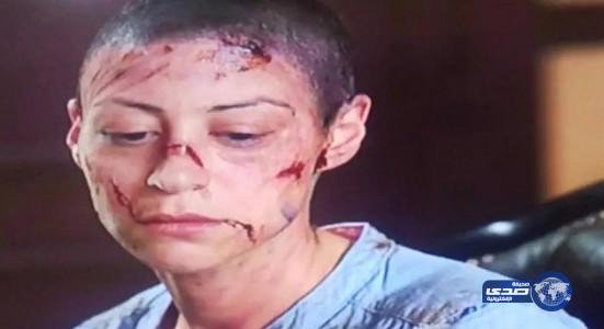 منة شلبي تُبكي المشاهدين وهي حليقة الرأس