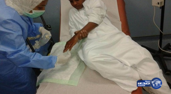 الألعاب النارية تودع طفلين المستشفى بتبوك