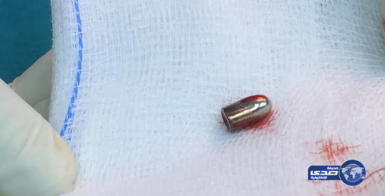 جازان.. انقاذ حياة مصاب استقرت رصاصة بـعضوه الذكري