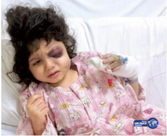 والد الطفلة السعودية المصابة برصاصة بالرأس في مسقط&#8221; يتنازل رسمياً عن العريس ووالده