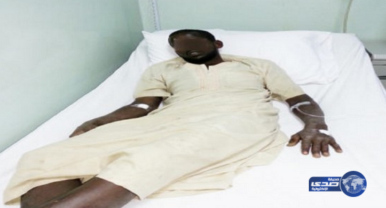 عقرب يدخل راعي غنم المستشفى في الخرمة