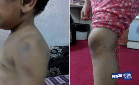“الشؤون الاجتماعية” تُسَلّم أطفال الباحة المُعَنّفين إلى والدتهم
