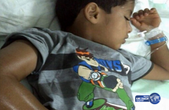 إعفاء مدير مناوب بمستشفى اﻷمير متعب بسكاكا بسبب “الطفل الملدوغ بالأفعى”