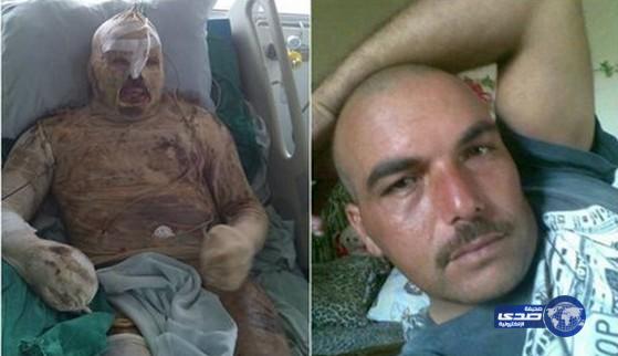 لبنانية اشعلت النار بجسد خطيبها واحرقته حتى الموت!