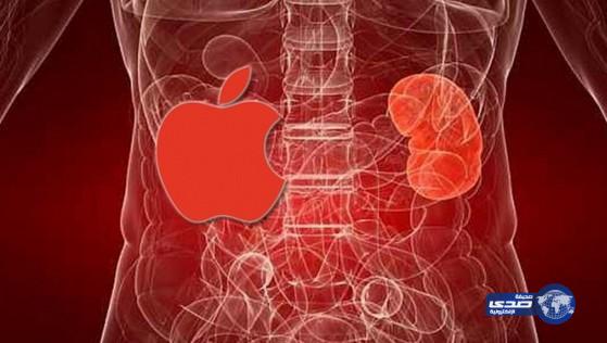 شاب يبيع كليته لشراء آيفون !