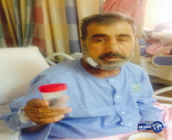 استخراج جسم معدني من فك حاج سوري أصيب في حادثة الرافعة