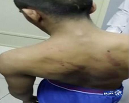 بالفيديو.. والد سلطان “معنف مركز التأهيل بجدة” يكشف تفاصيل الاعتداء على نجله