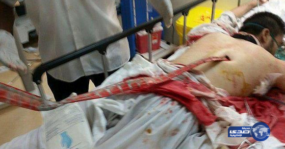 استخراج سيخ حديدي من ظهر مصاب في حادثة “رافعة الحرم”(صور)