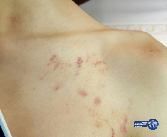 تركيا تعتذر لأسرة سعودية إثر تعرض أبنائها للضرب في مطار إسطنبول