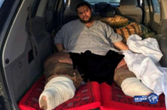 ولي ولي العهد يتكفل بنقل المريض تركي الغامدي إلى ألمانيا