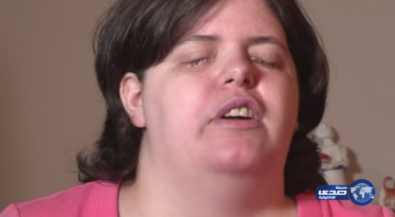 بالفيديو | أمريكية تضع سائل تنظيف في عينيها لتحقق حلمها بأن تصبح ضريرة