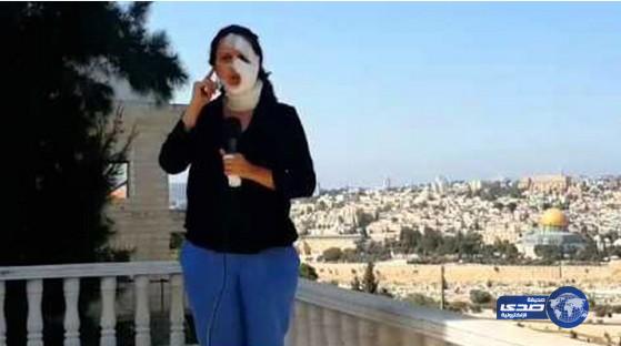 بالفيديو: مراسلة فلسطينية تظهر على الهواء رغم إصابتها