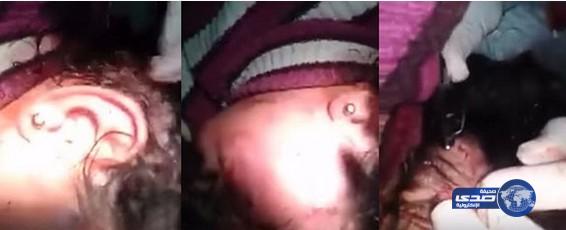 بالفيديو: طفلة سوريّة تقرأ ‫القرآن‬ للتخفيف من ألم الخياطة دون مخدر