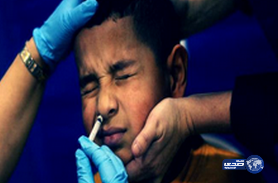 تسجيل إصابة بفايروس &#8220;إنفلونزا الخنازير&#8221; لطفل في محافظة عفيف