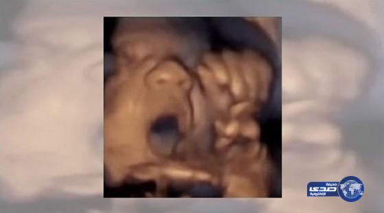 بالفيديو.. طفل &#8220;يغني&#8221; وهو في بطن أمه