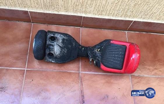 مواطن ينجو من حريق بسبب «السكوتر الذكي»