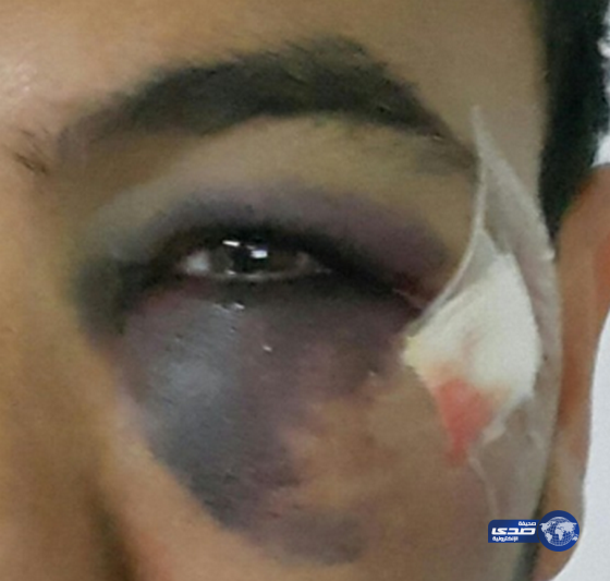 طبيب بمستشفى بريدة المركزي يعتدي على أحد المراجعين بالضرب