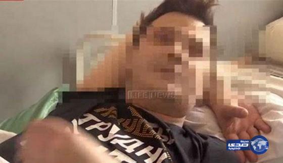 قبلة “اعلامي “افقدته أعضائه التناسلية