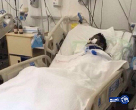 شقيق سعود حمود ينفي وفاته ويؤكد: حالته مستقرة – فيديو