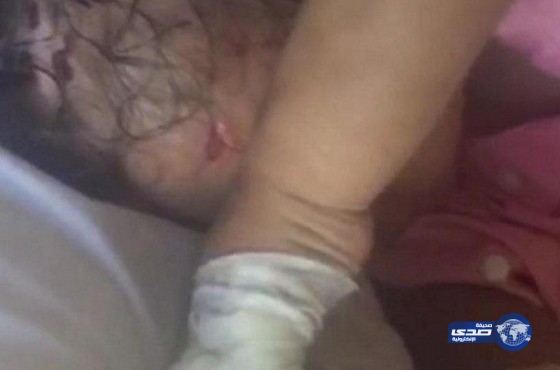 الشؤون الاجتماعية تتسلم الطفلة “ليان” وفيصل بن خالد يوجه بكشف معنفها